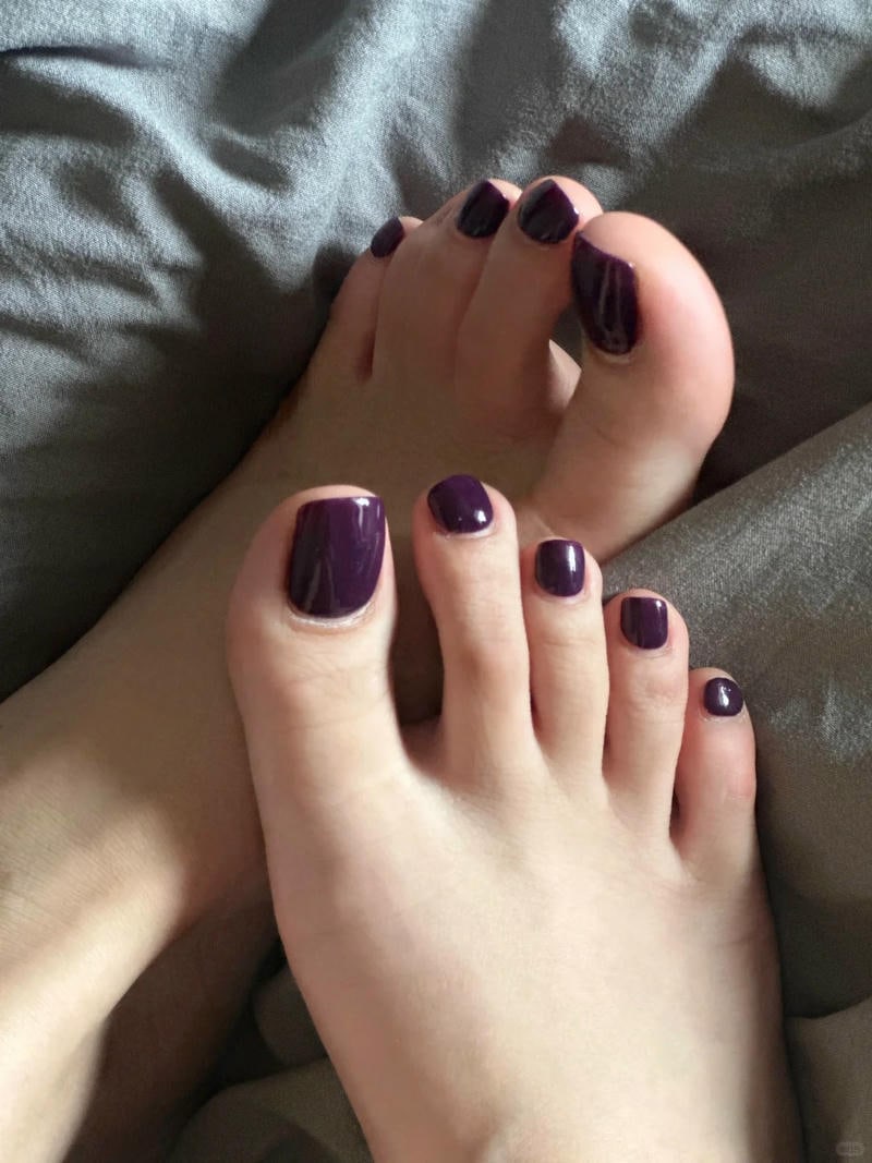 nail móng chân tím nhẹ